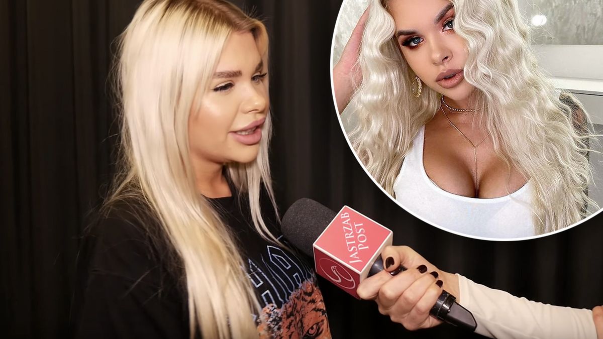 Magda Jankowska z Hotel Paradise o operacjach plastycznych