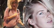 Edyta Pazura zdradziła swoją wagę w ciąży! Żadna gwiazda nie była do tej pory tak odważna. Dużo przytyła?