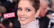 Co się stało z twarzą ślicznej Cheryl Cole? Rewolucyjna zmiana. Także na głowie