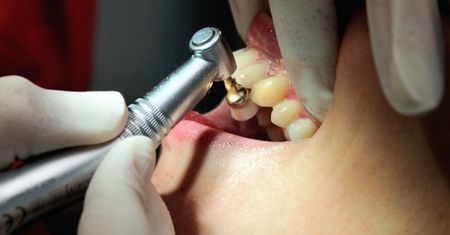 Dentofobia - dlaczego faceci boją się dentysty?
