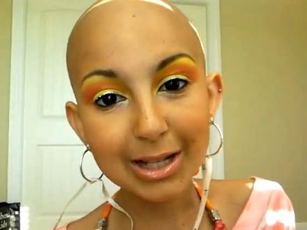 Chora na raka 13-latka została twarzą firmy kosmetycznej