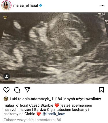 Mała Ania jest w ciąży