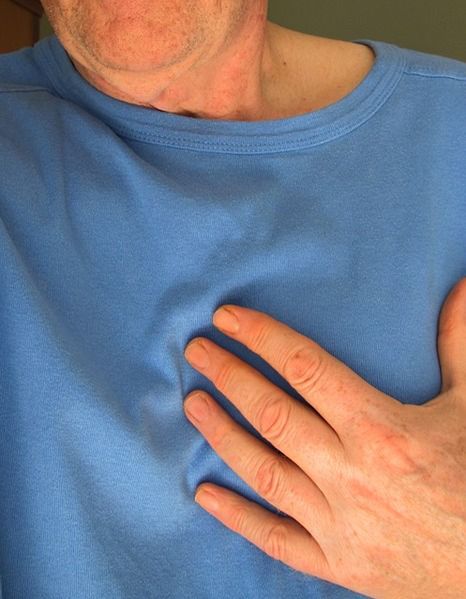 Obniżenie ryzyka zawału serca