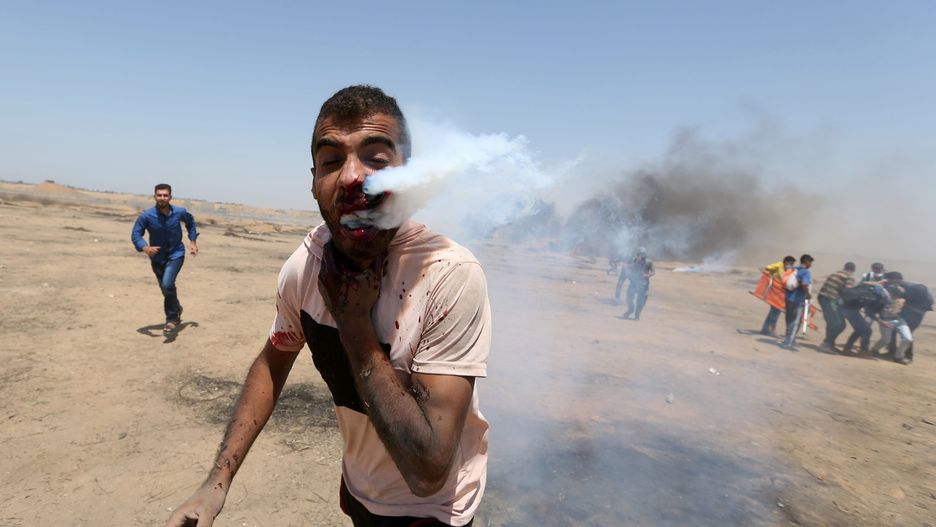 23-letni Palestyńczyk walczy o życie po tym, jak pocisk z gazem łzawiącym trafił go w twarz