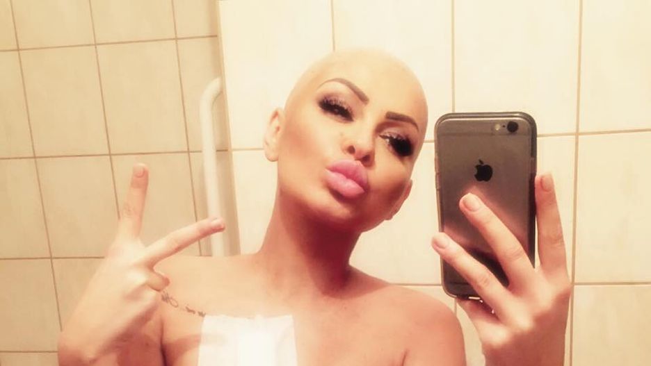 Ania Szubert nazywana najweselszą pacjentką onkologiczną.