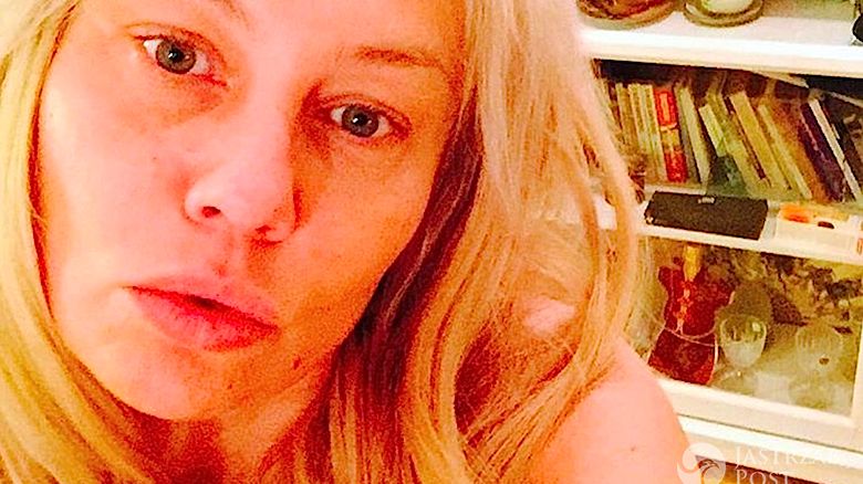 Monika Jarosińska o usunięciu tętniaka