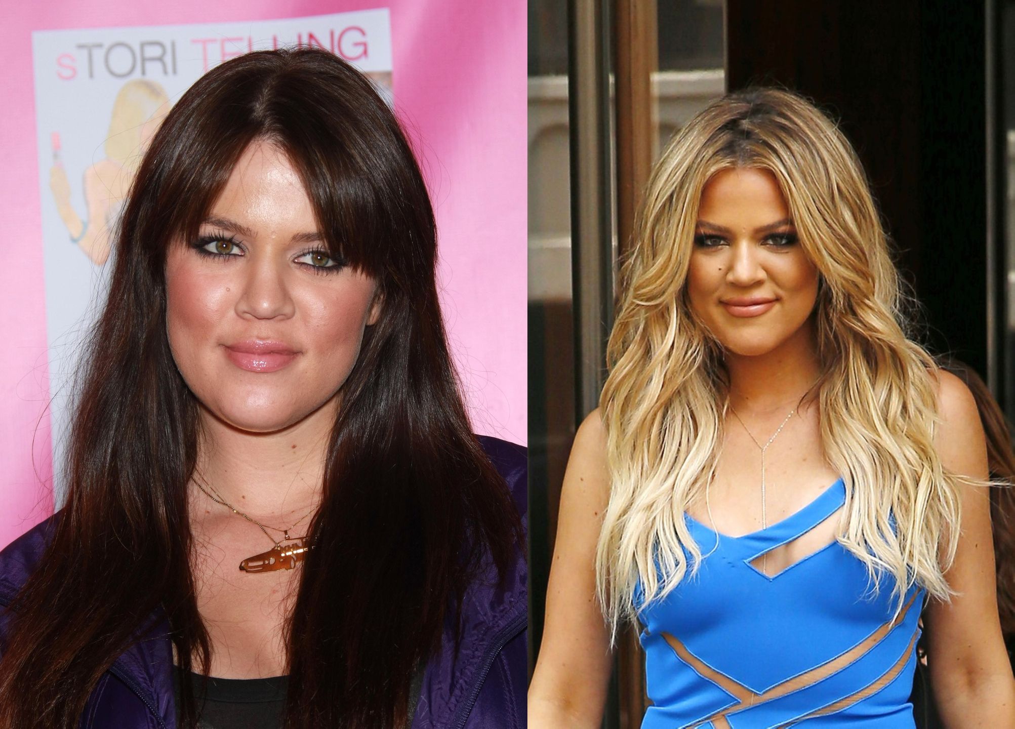 Khloe Kardashian 