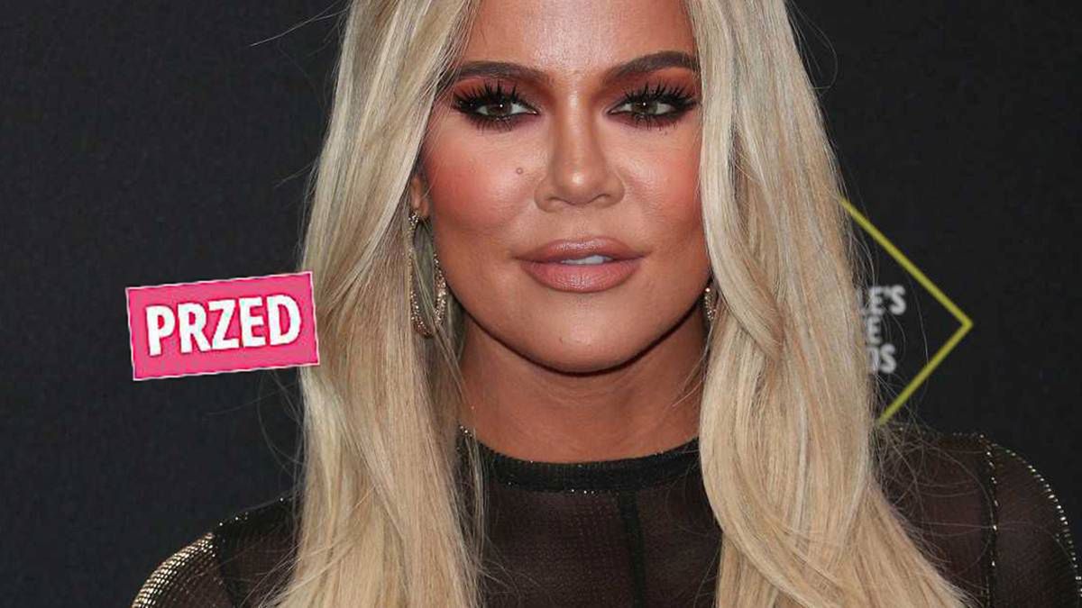 Metamorfoza Khloe Kardashian. Szokujące zdjęcia: "Kim jesteś?"