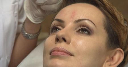 Dorota Gardias dostała w twarz szklaną butelką. Teraz usunie bliznę na wizji