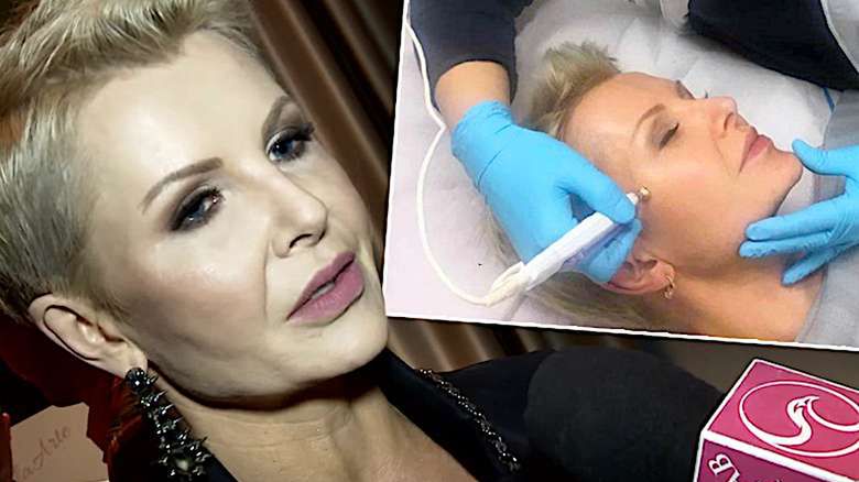 Joanna Racewicz, dlaczego poprawia urodę