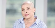 Agata Kościkiewicz o raku. Nie ma z czego żyć