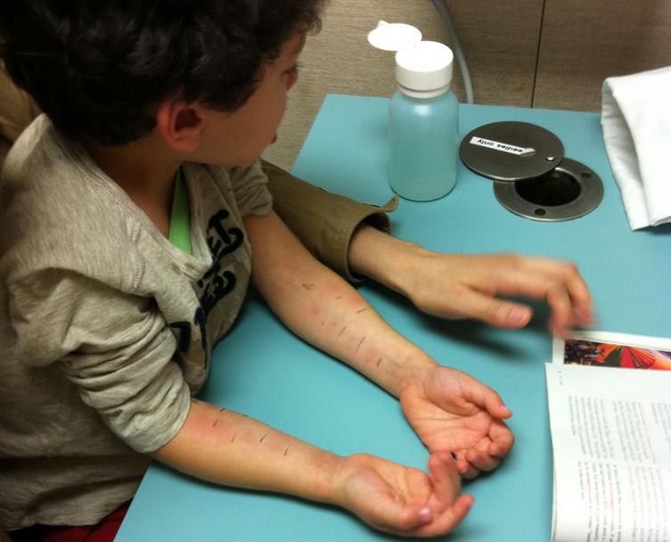 Dziecko na wizycie u alergologa 