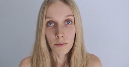 Agnieszka przeżyła 22 dni bez jedzenia. Pokazuje, jak wygląda jej ciało