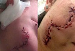 Rozbitą butelką pociął twarz dwóm kobietom. Do sądu trafił akt oskarżenia