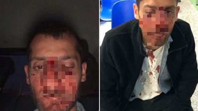 Pobicie Żydów w Warszawie. Prokuratura wszczyna śledztwo