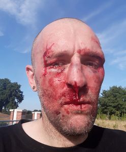 Wrocław. Publicysta zwrócił uwagę na graffiti, po czym został pobity