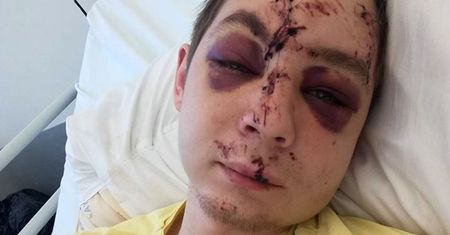 Apel rannego 22-latka z Krakowa. Pan Kacper: bez etatu nie mam za co żyć