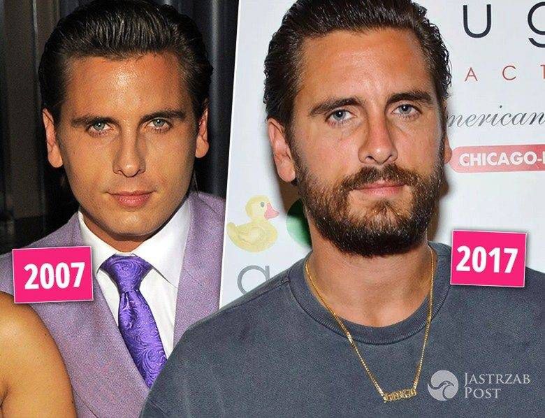Scott Disick - kiedyś i dzisiaj, metamorfoza