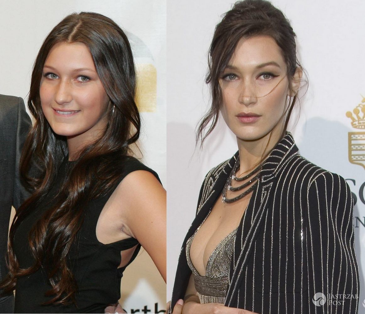 Bella Hadid w 2010 r. przed operacją plastyczną nosa i w 2016 r. (fot. ONS)