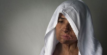 Prawo islamskie pozwala "lekko" uderzyć żonę. Rezultaty są straszne