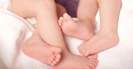 Lekarz zdębiał. Takich bliźniąt nie widział