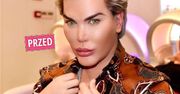 "Żywy Ken" zmienił płeć. Usunął wszystkie zdjęcia i wraca totalnie odmieniony. Wygląda jak umięśniona Barbie