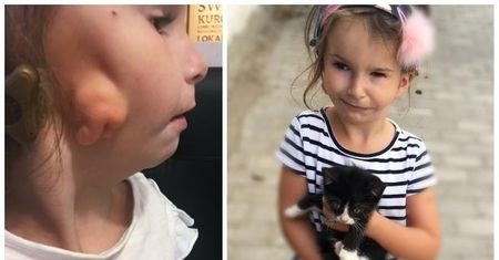 Szczecin. Skradziono pieniądze zbierane na leczenie 5-letniej Mai