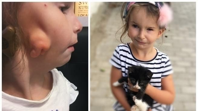 Szczecin. Skradziono pieniądze zbierane na operację dla 5-letniej Mai Tucholskiej.