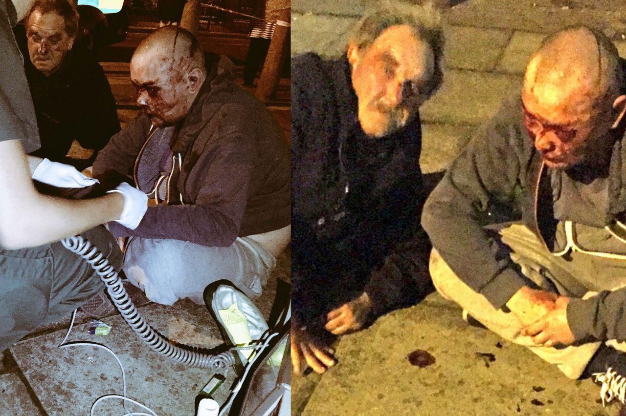 Ataki na Polaków w Wielkiej Brytanii