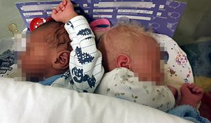 Bliźnięta o różnych kolorach skóry urodziły się w łódzkim szpitalu