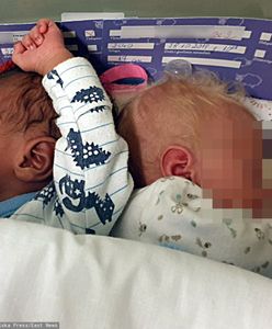 Bliźnięta o różnych kolorach skóry urodziły się w łódzkim szpitalu