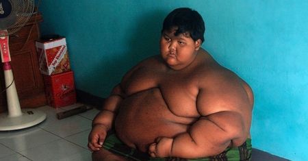 Najgrubsze dziecko świata schudło 106 kilogramów