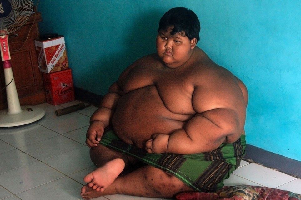 Najgrubsze dziecko świata schudło 106 kg.