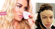 Katie Price ma "nową twarz"! Modelka poddała się serii zabiegów. Efekt osiągnęła już po kilku dniach