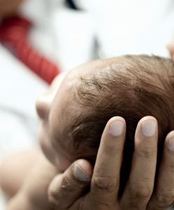 Dziecko urodzi się dwa razy. Zespół chirurgów z Belgii zoperował 7-miesięczną dziewczynkę przed jej narodzinami