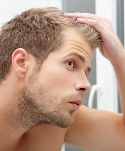 5 skutecznych sposobów na męskie łysienie
