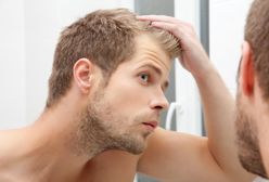 5 skutecznych sposobów na męskie łysienie
