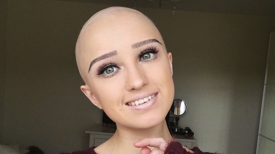 Lauren zaczęła łysieć jako nastolatka. Ukrywała to przed wszystkimi. 