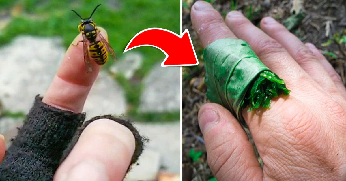 Have You Been Stung by a Wasp? Relax – There Are at Least 10 Home-Made Ways to Ease the Pain