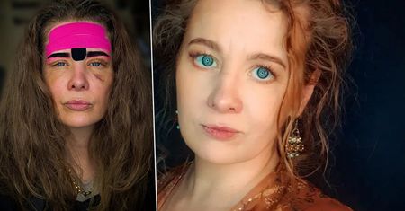 Anna Powierza pokazała twarz po zabiegach upiększających. Auć! Boli na sam widok