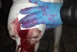 Amstaffa, który pogryzł dziecko, prowadziła 15-latka. Usłyszała zarzuty