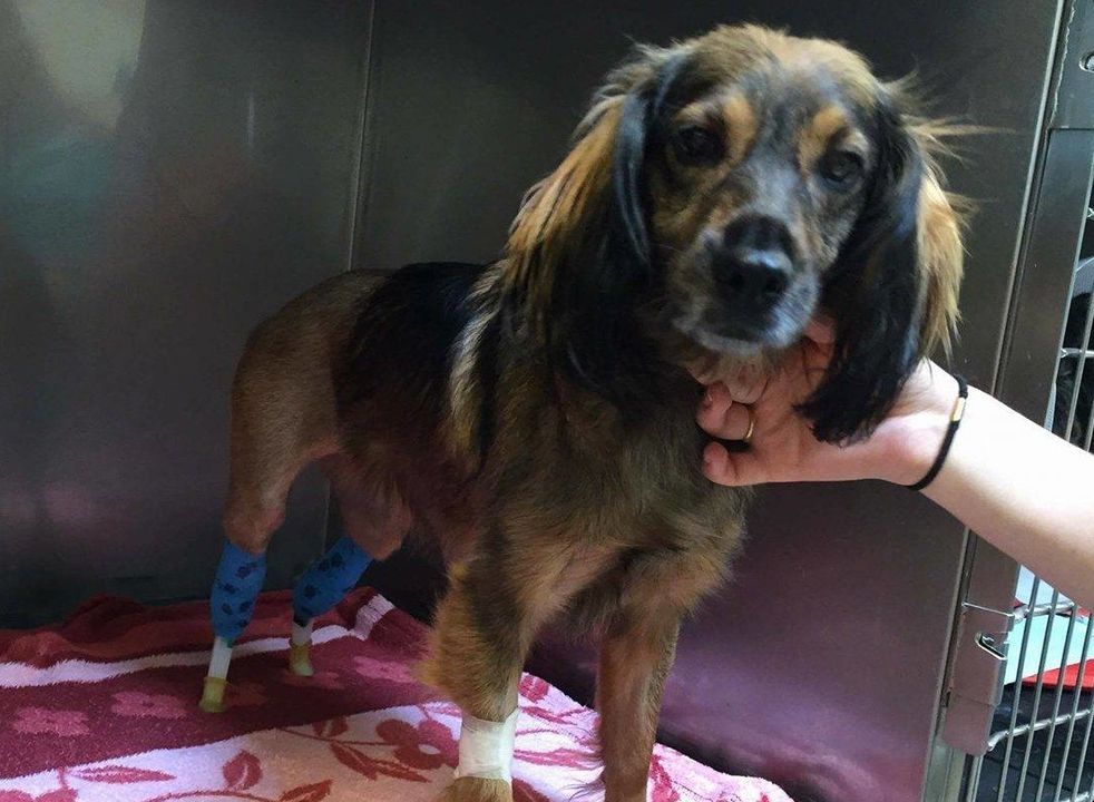 Straciła nogi. Lekarze podarowali jej nowe