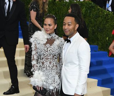 Chrissy Teigen tym razem przesadziła? Co się stało z jej twarzą?