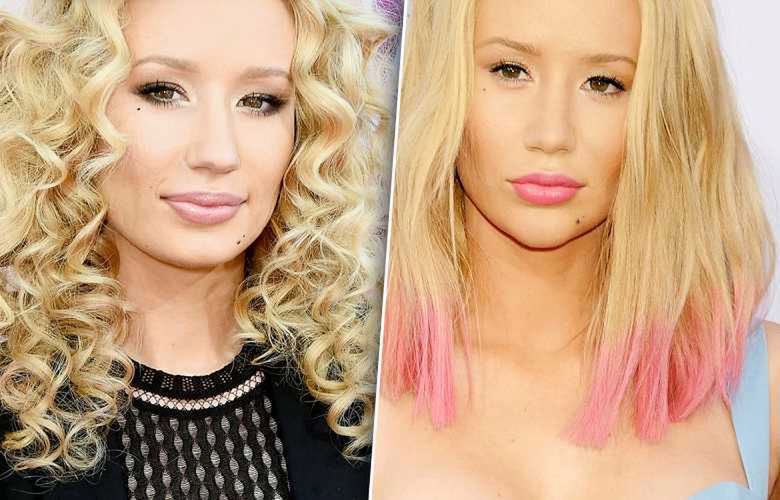 Iggy Azalea miała operację plastyczną nosa? Zdjęcia przed i po