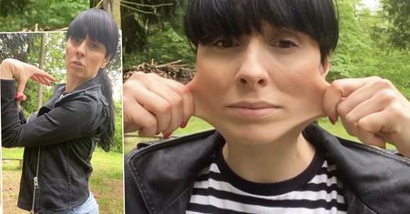 Tatiana Okupnik pokazała, co z jej ciałem robi EDS. Lekarze latami bagatelizowali objawy