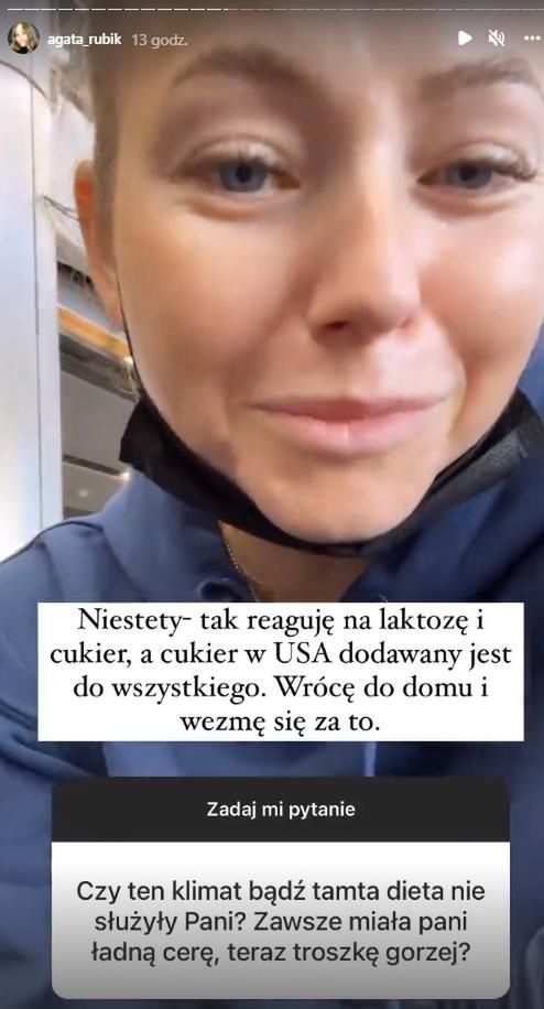 Agata Rubik o problemach z cerą