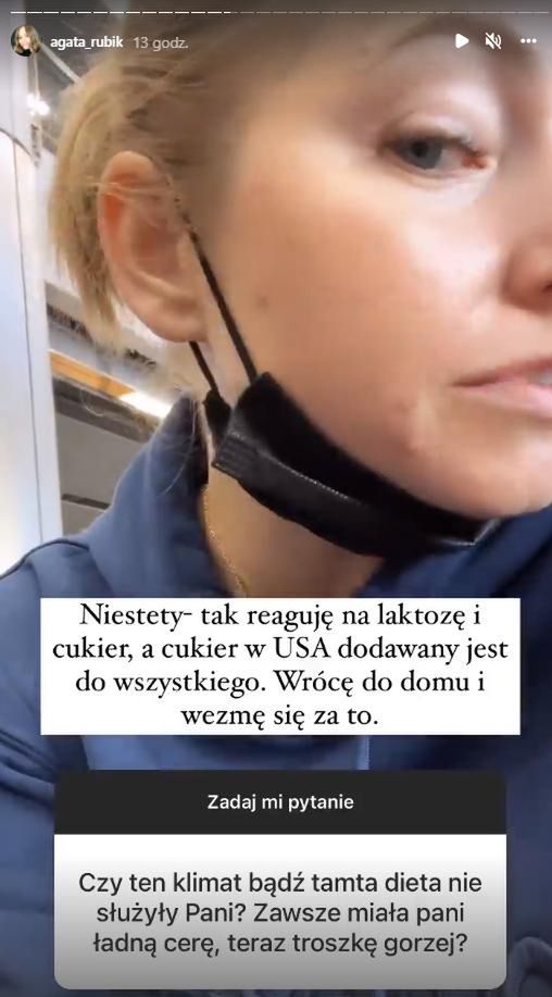 Agata Rubik o problemach z cerą