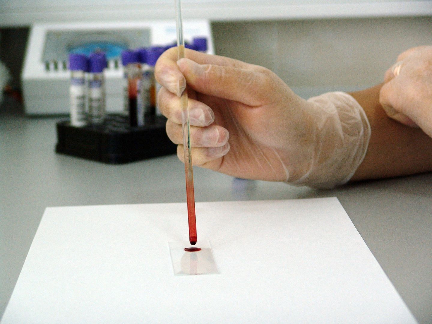 Badania krwi pozwolą na wczesne wykrycie raka jajników
