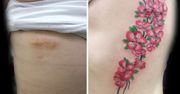Artystka zamienia blizny w tatuaże