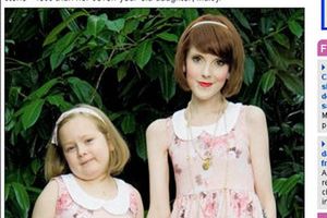Cierpiąca na anoreksję matka jest szczuplejsza od 7-letniej córki